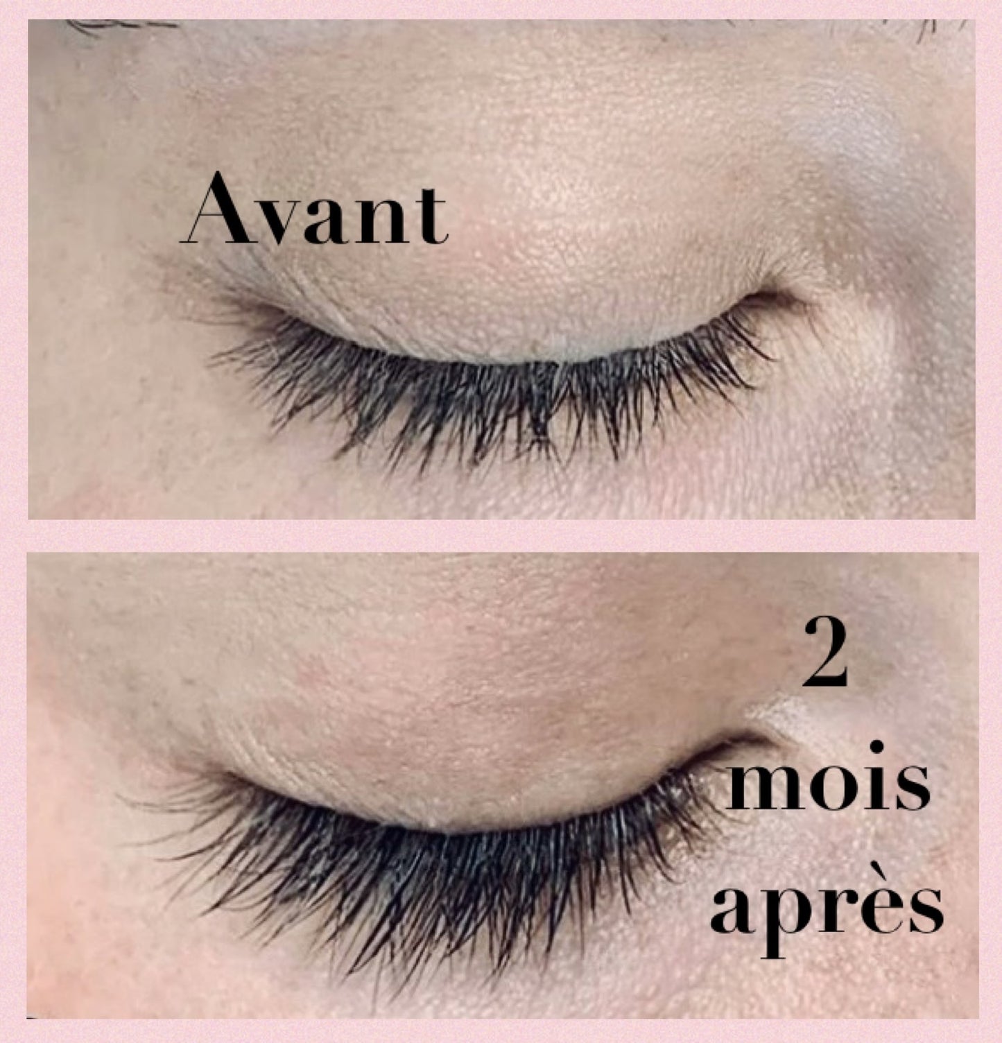 Sérum pour cils compatible avec extensions de cils Innovation Esthétique